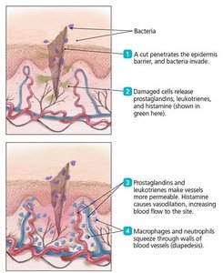 Overview of inflammation events following a cut and infection (part 1)