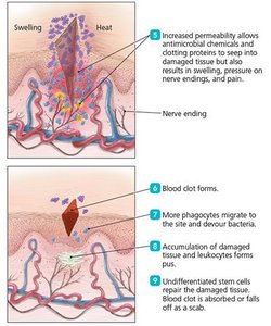 Overview of inflammation events following a cut and infection (part 2)