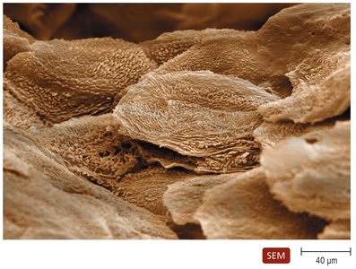 Scanning electron micrograph of the surface of human skin