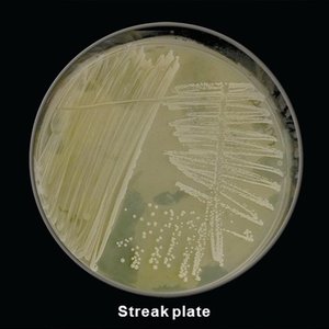 Streak plate example