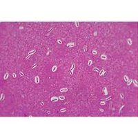 Microscopic image of encapsulated bacteria