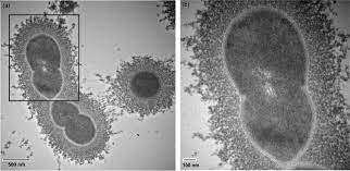 Electron micrograph of bacterial capsules