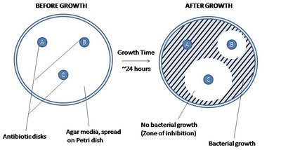 Kirby-Bauer diffusion susceptibility test