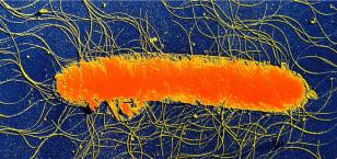 Amphitrichous and endoflagella arrangements