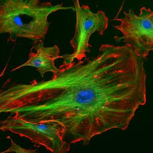 Fluorescent image of cytoskeleton
