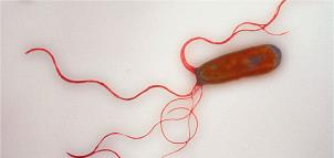 Lophotrichous flagella