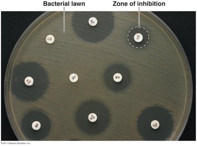 Zone of inhibition in a diffusion susceptibility test