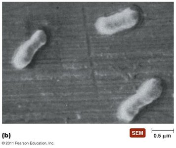 SEM of bacterial cells