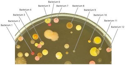Bacterial colonies on agar