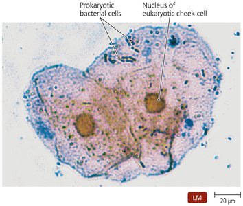 Bacterial cells and human cheek cells