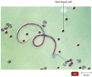 Parasitic worm in blood