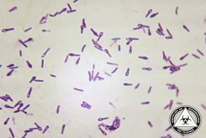 Clostridium tetani under microscope