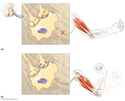 Mechanism of tetanus toxin action