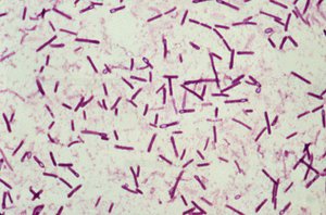 Clostridium botulinum under microscope
