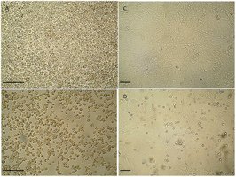 Inclusion bodies in viral infection