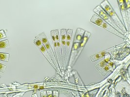 Microscopic image of algae, a major group of eukaryotes