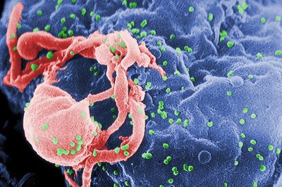 Electron micrograph of HIV particles budding from a cell