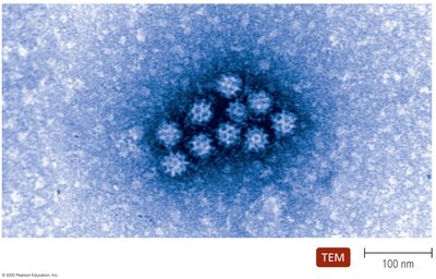 TEM of norovirus particles