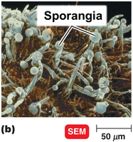 Scanning electron micrograph of fungal sporangia