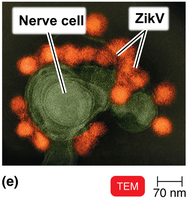 Transmission electron micrograph of Zika virus particles around a nerve cell