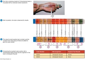 Rapid identification method for bacteria: EnteroPluri Test