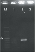 Identification of a common coronavirus strain by PCR and gel electrophoresis