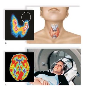 Medical imaging using radioisotopes