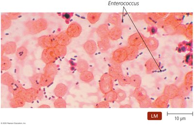 LM of Enterococcus in tissue