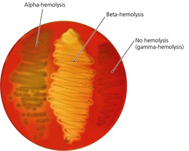 Blood agar showing alpha, beta, and gamma hemolysis