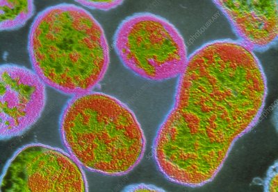 Colored TEM of Brucella abortus