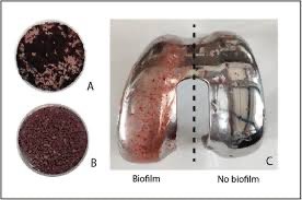 Comparison of biofilm presence on medical implant surfaces