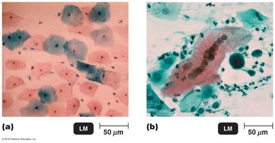 Cytopathic effect of viruses in cell culture