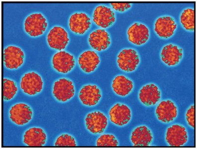 Hepatitis B viruses under electron microscope