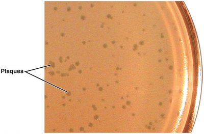Plaques formed by bacteriophages on agar