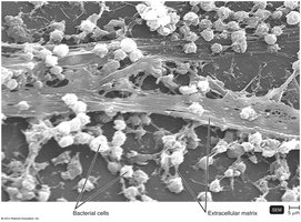 Staphylococcus aureus biofilm on a catheter