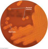 Blood agar showing hemolysis