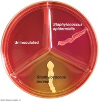 Mannitol salt agar: selective and differential medium
