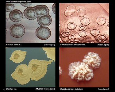 Colony margin types