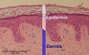 Histological section of skin showing epidermis and dermis