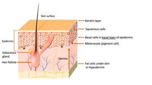 Diagram of skin layers including keratin layer, squamous cells, and basal cells
