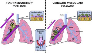 Healthy vs unhealthy mucociliary escalator in the respiratory tract