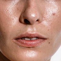 Oily skin representing sebum secretion