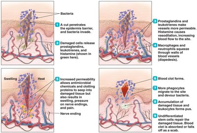 Overview of the events of inflammation