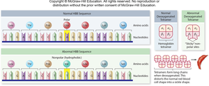 Sickle cell mutation: normal vs abnormal hemoglobin