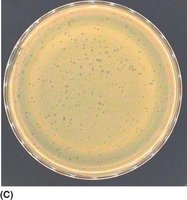 Bacteriophage plaques on agar plate