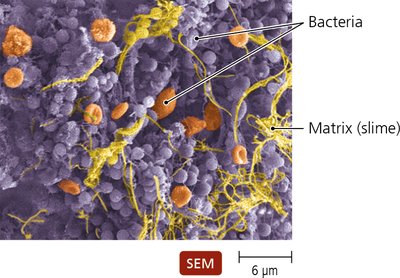 SEM image of a bacterial biofilm with matrix (slime)