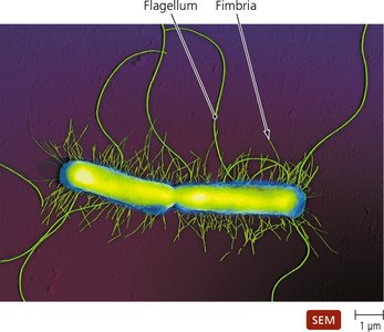 SEM image showing bacterial flagella and fimbriae