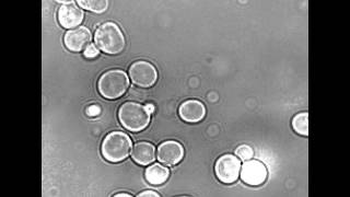 Yeast cells under microscope