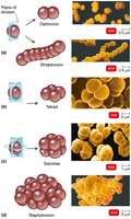 Arrangements of Cocci: diplococci, streptococci, tetrad, sarcinae, staphylococci