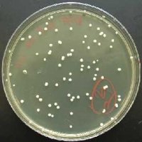 Yeast cells (Saccharomyces cerevisiae)